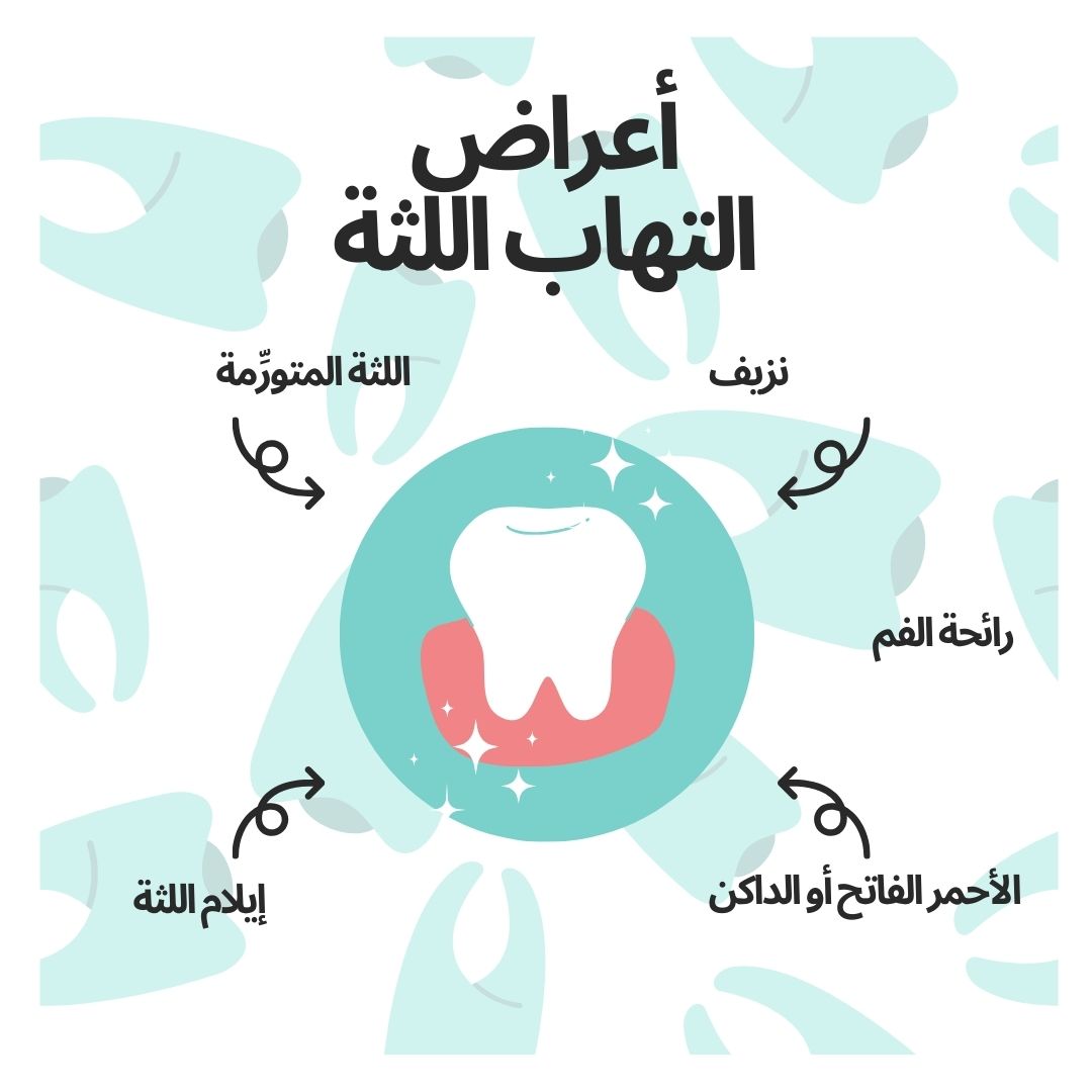 التهاب اللثة
